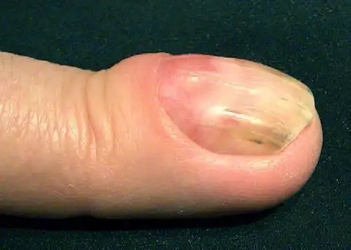 指甲出现7个表现,说明肝已受损!无论男女,三件养肝事要多做