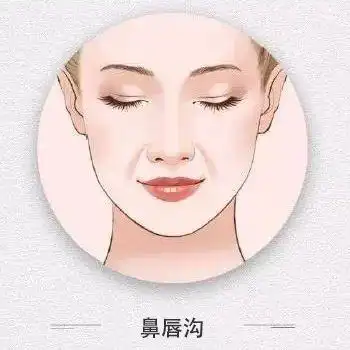 鼻唇沟问题单纯填充就能改善吗?