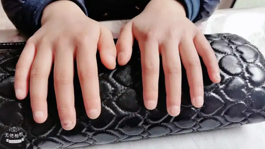 8岁小朋友的手0202