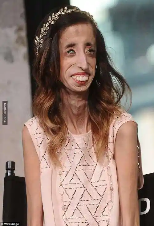 她曾被讥讽是「世界上最丑的女人」要她赶快自杀