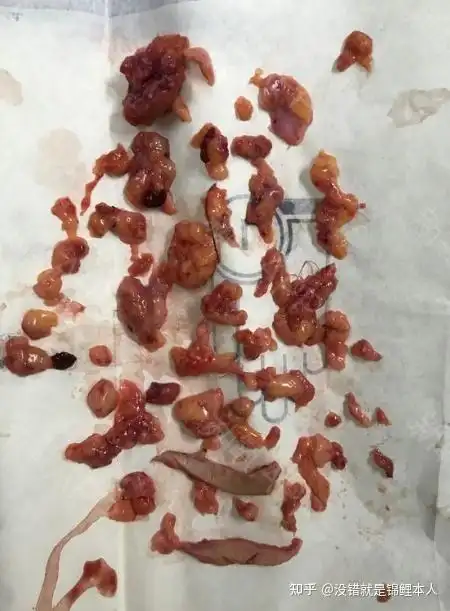 2021国内奥美定,生长因子,骨粉等不明注射物取出医院医生名单