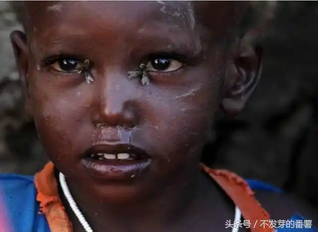 实拍脸上叮满苍蝇的非洲儿童,替他们感到浑身难受