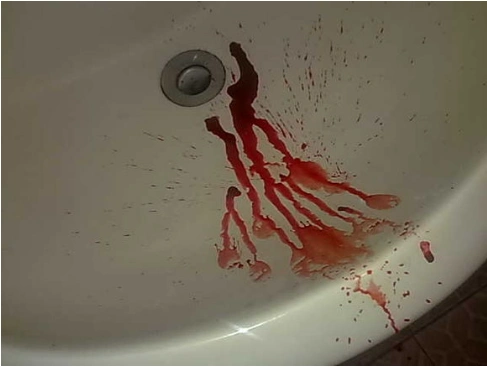 什么没有事,流血流成这样!