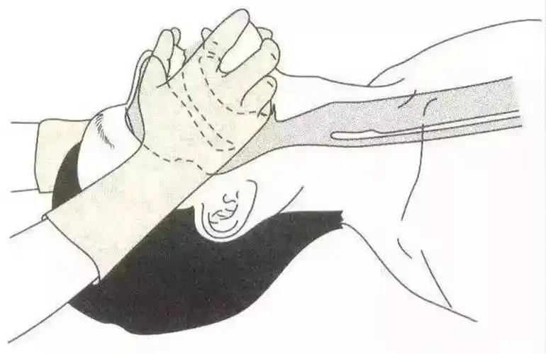 "1001,1002,1003……"是代表心肺复苏按压了1000多次吗?