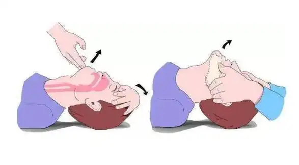正确人工呼吸方法
