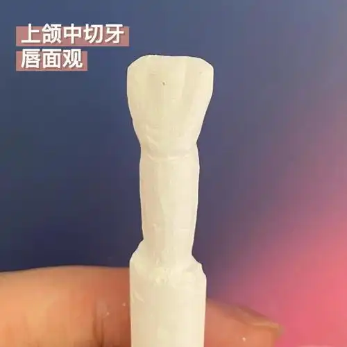 远中面观51566上颌中切牙 切端观#口腔解剖生理学  #口腔雕牙