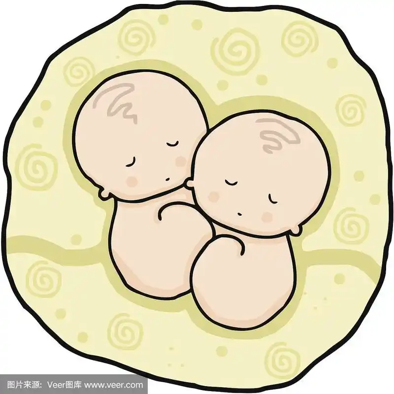 双胞胎,小的,脐带,绘画插图,人