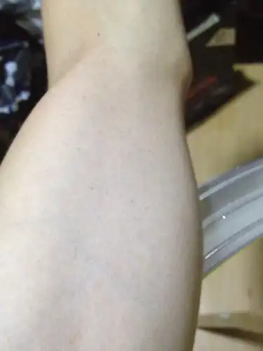 为什么我手臂会长这些斑点.很多.胸前也会有一点