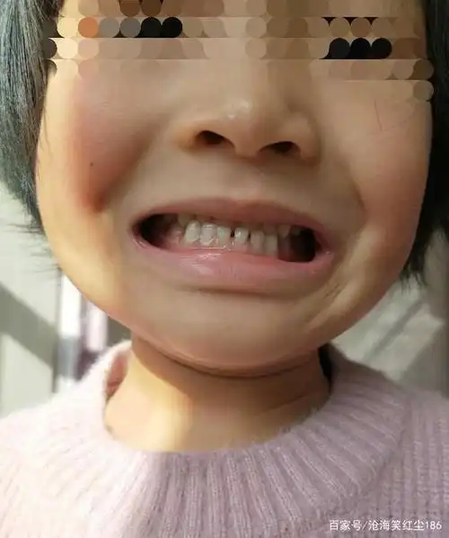 有一种遗憾叫后悔没有发现孩子的"地包天"