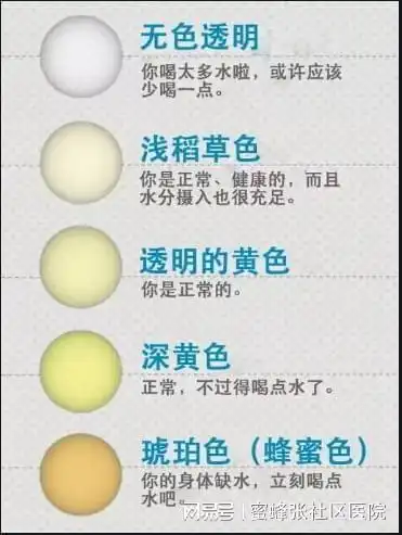 你知道吗尿液颜色有12种代表身体不同状况
