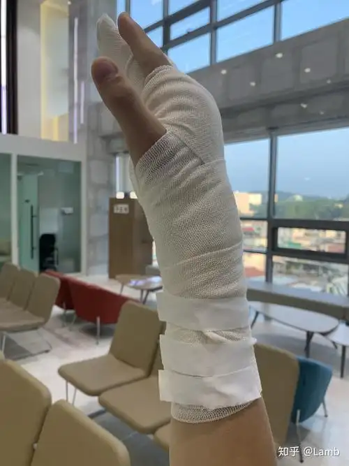 7日,在鸡蛋加工厂公司的机器右手被机器严重烫伤,人生第一次经历如此