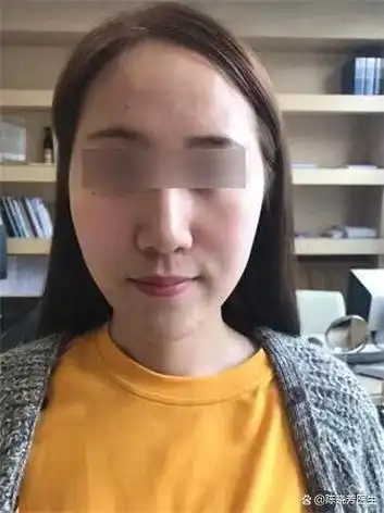 无非是鼻子不够高,额头以及苹果肌不饱满等.