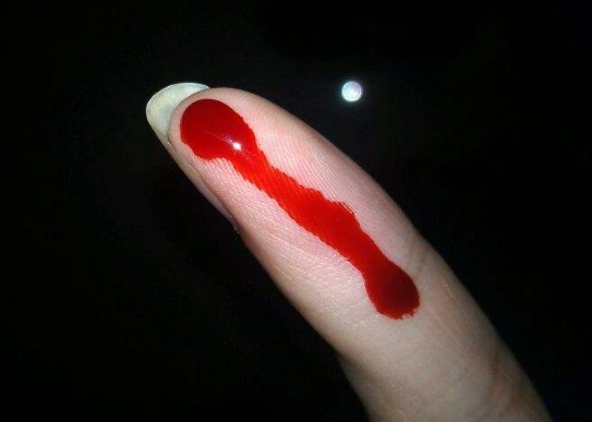 手出血的图片61