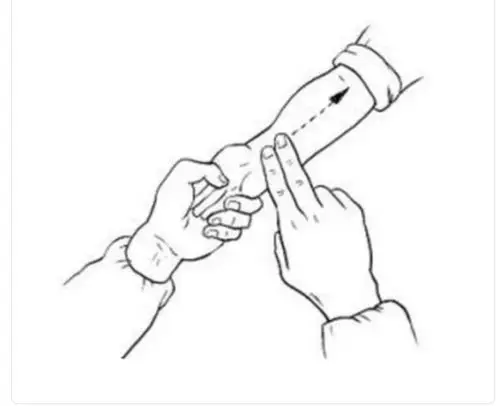 小儿推拿退烧六步图.