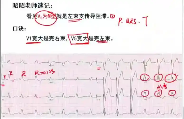 执医/ 心电图步骤要点总结