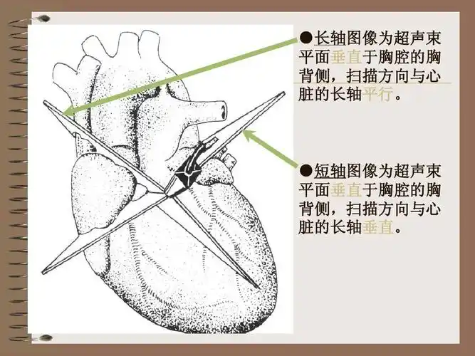 短轴图像为超声束 平面垂直于胸腔的胸 背侧,扫描方向与心 脏的长
