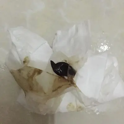 上厕所的时候流出一块这样的东西还有这样颜色的啊知白带还是血,好