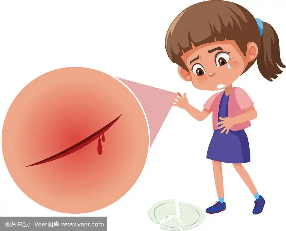 一个女孩割破了手指