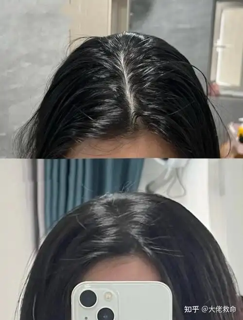 女生头发细软容易出油贴头皮,如何让头发蓬松