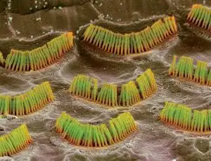 基因疗法,失聪者的福音