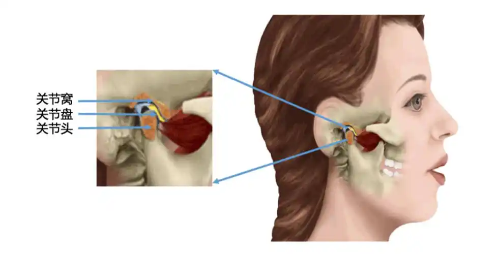 科普讲座〕不容忽视的关节盘前移位_颞下颌关节紊乱病_介绍_症状