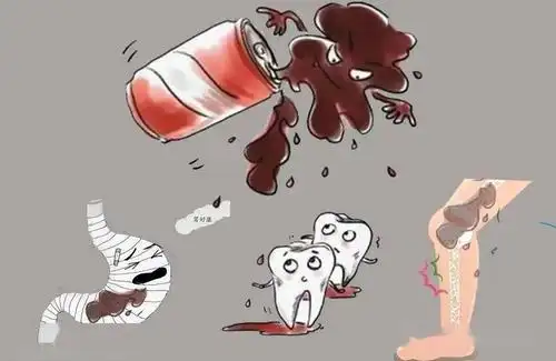 高阳妇幼61儿童眼健康经常喝碳酸饮料真的会加速近视度数增加