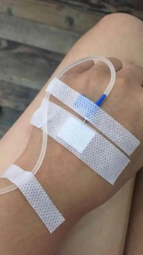 打分 吃的上吐下泄,海鲜太差了,第一次吃海鲜这样,急性肠胃炎,吊水