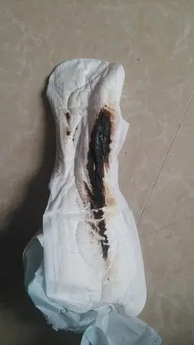 是月经还是流产