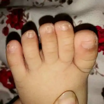 问答 婴儿期0-1岁 育儿问题这裏搜 取消 相关知识 相关问答 怀孕养娃