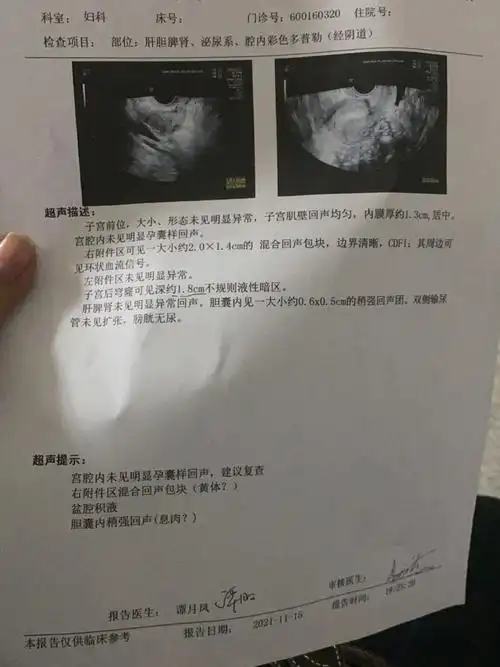 11月15 肚子有点不舒服去医院然后医生说情况不太好 疑似宫外孕11月16