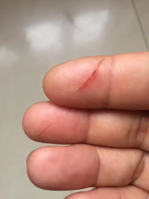 边缘锋利,划伤手指_中国质量万里行消费投诉平台