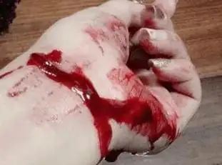 网路直播割腕竟然是