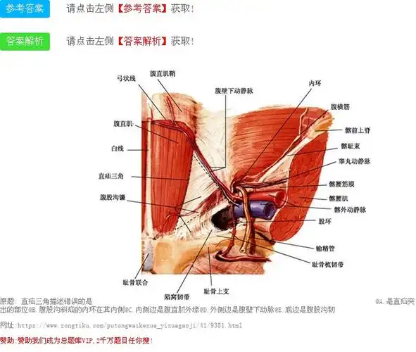 直疝三角描述错误的是