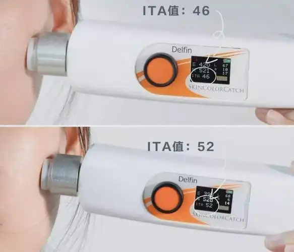 写给脸上长斑的女生