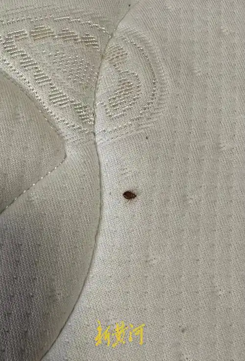 出租房内3岁孩子被床虱咬伤,房东称房子移交完毕不清楚来源