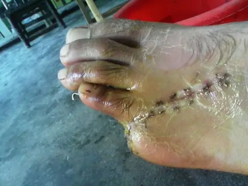 工伤赔偿问题,请对法律有研究的大神为我解答.