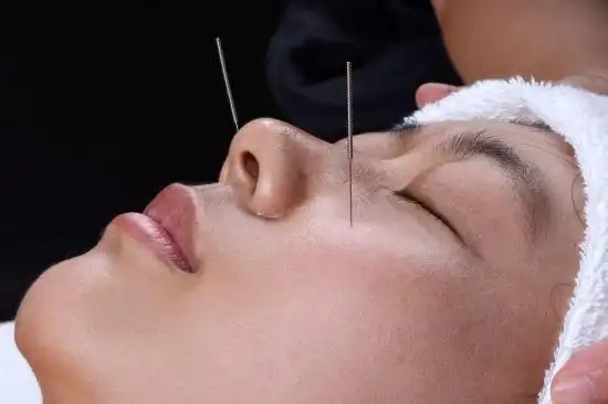 中医"针灸健康随手拍"国际摄影比赛获奖作品