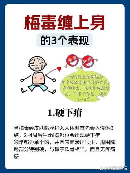 很有可能是梅毒在作怪  br>快看看这些表现你有没有71  br>硬下疳