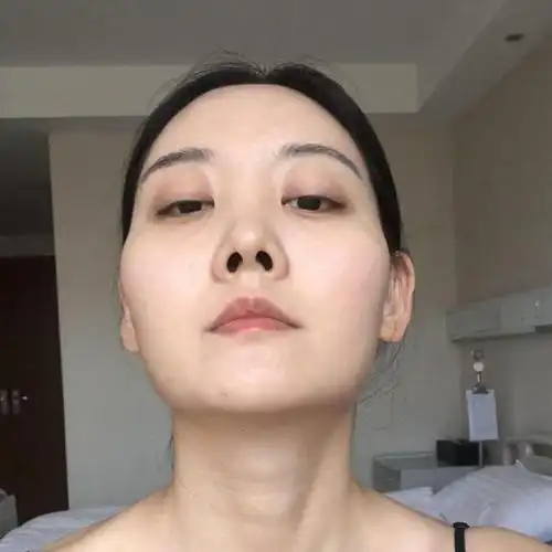 颧骨高,下颌宽,大脸盘子就真的没办法了吗?