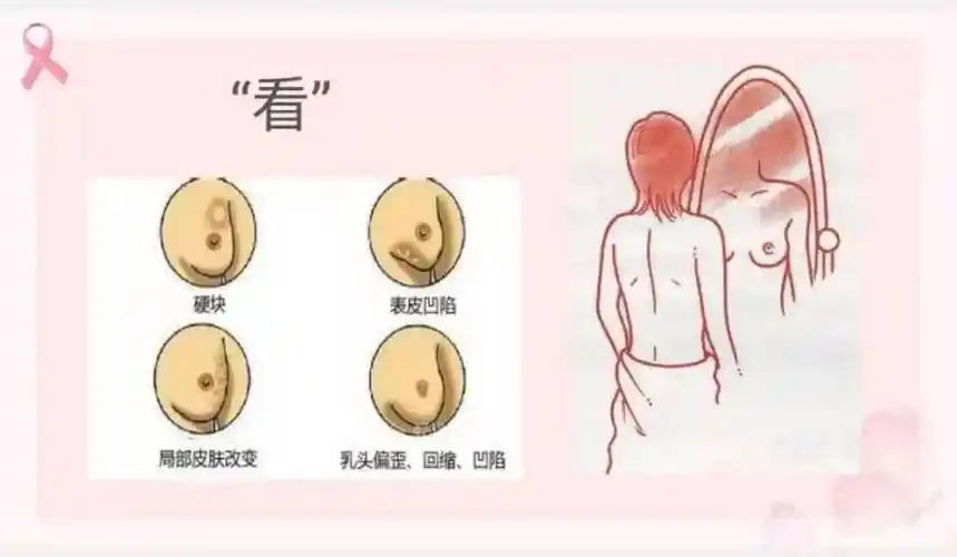 诊治_乳房_疾病