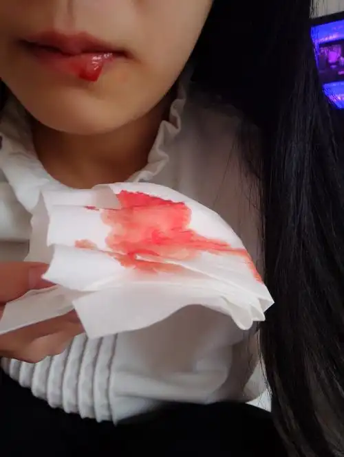 男生来回答,如果你女友发短信给你说她吐血了,并附上一张下图照片