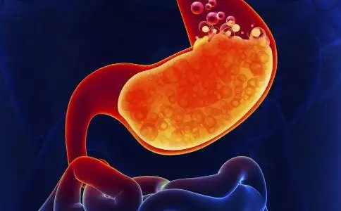 什么原因导致胃酸过多 治胃酸过多有好方法