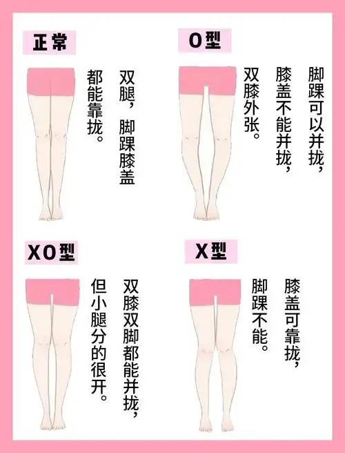 78腿型自测734大类腿型你是哪一种63