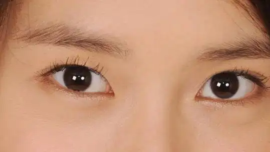 双眼皮过窄 双眼皮太窄容易随着眼周皮肤的松弛下垂"塌"掉变成内双