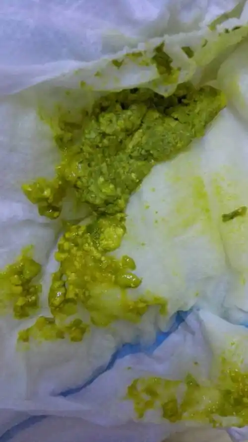 问:两个多月的宝宝拉绿屎怎么办