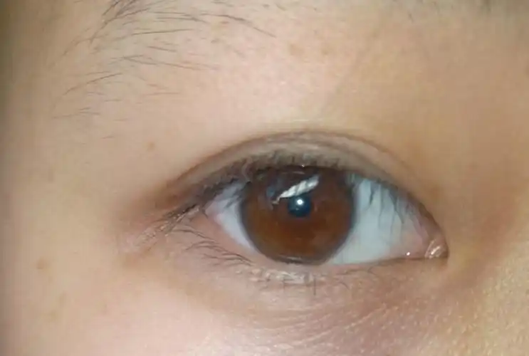 为什么中国人的眼睛是乍看像黑色的棕色,而西方人眼睛的颜色很多?