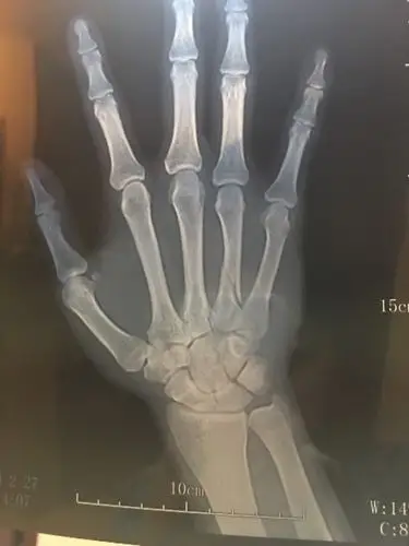 请专家帮忙解答.