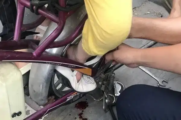 "咦,怎么踩不动?"奶奶回头一看,孙女的脚被卡得直流血