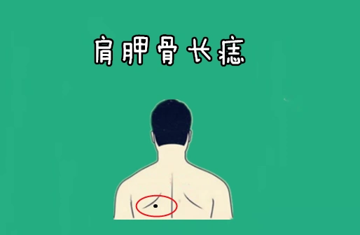 身上5颗"巨富"痣,颗颗显贵,个个财大气粗,老了有钱又有|巨富|肩胛骨