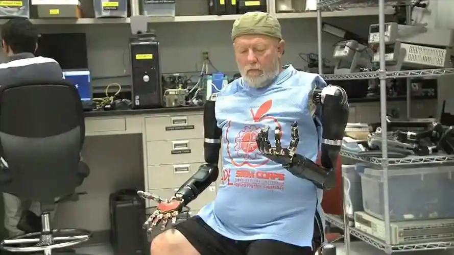 国外研发机械假肢装上如同真手臂残疾人的福音